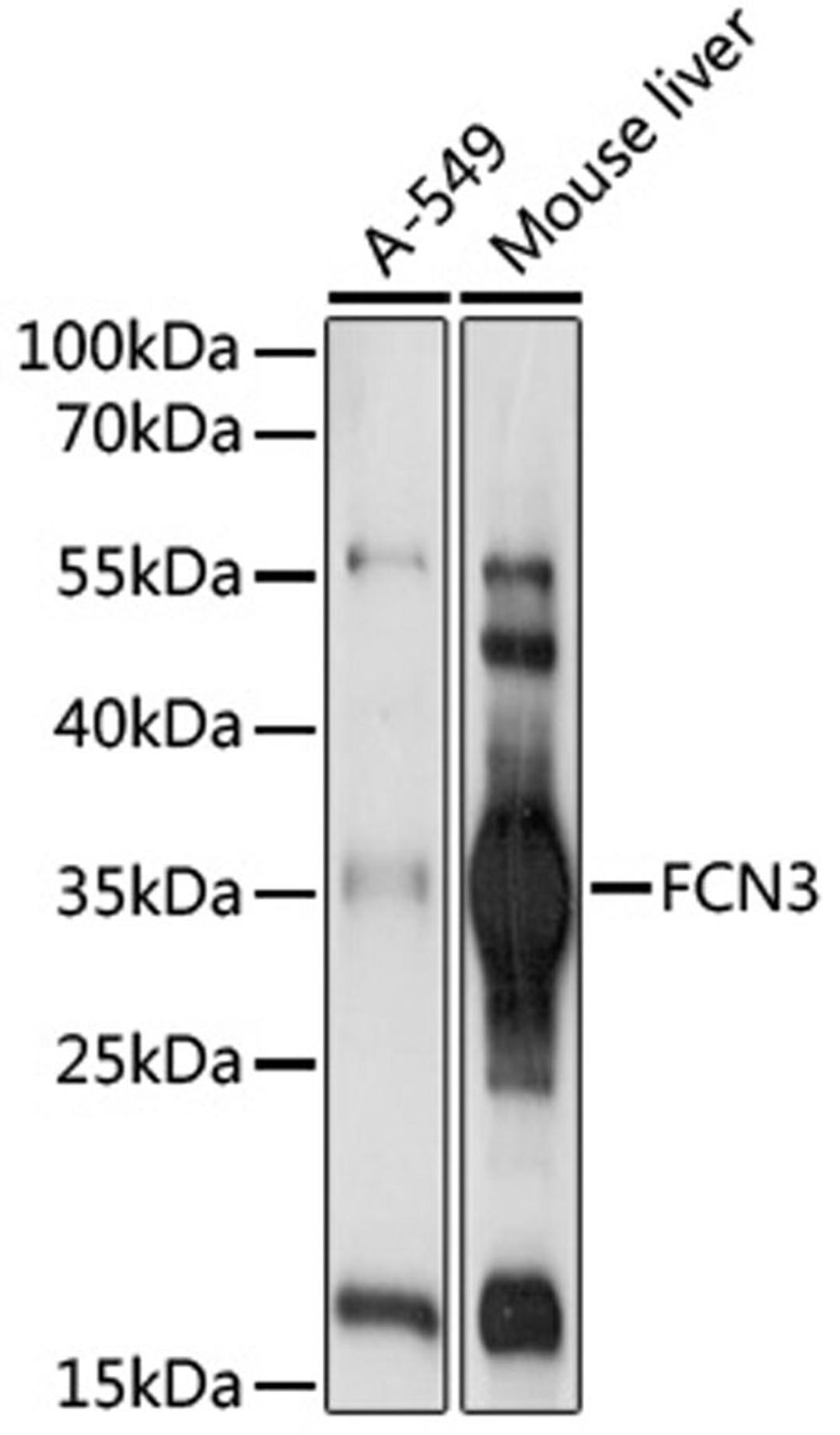 Western blot - FCN3 antibody (A17352)