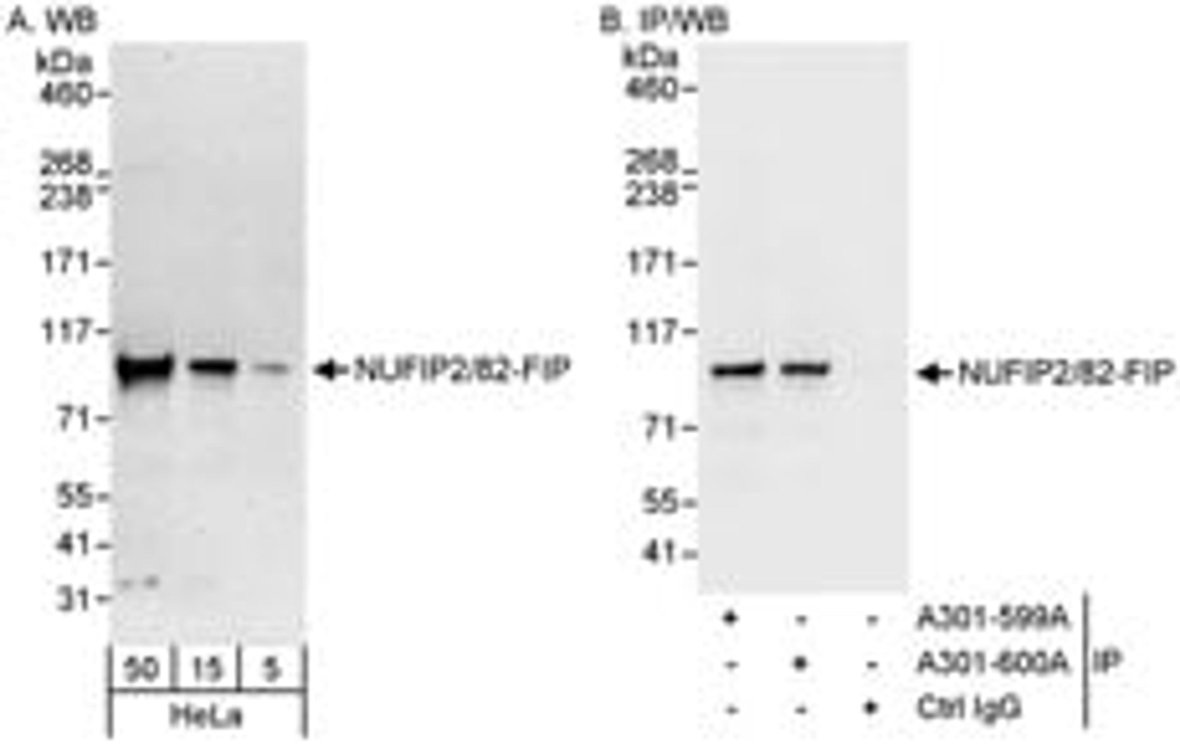 Detection of human NUFIP2/82-FIP by western blot and immunoprecipitation.