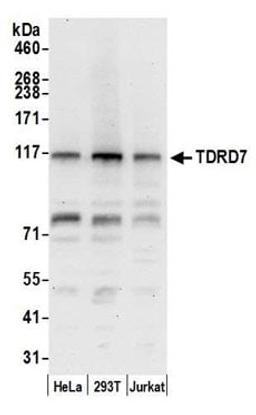 Detection of human TDRD7 by western blot.