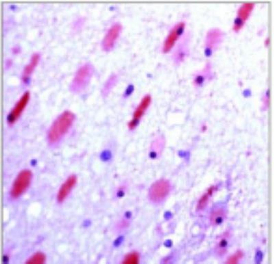 Immunohistochemistry: Glutamate Receptor 6/7 Antibody [NBP2-12629] - IHC: Human brain tissue stained with  Anti-GluR6/7 antibody  1:50 for 10 min @ RT. Staining of formalin-fixed tissue  requires boiling tissue sections in 10 mM Citrate Buffer, pH 6.0 for 10 min followed by cooling at RT for 20 min.