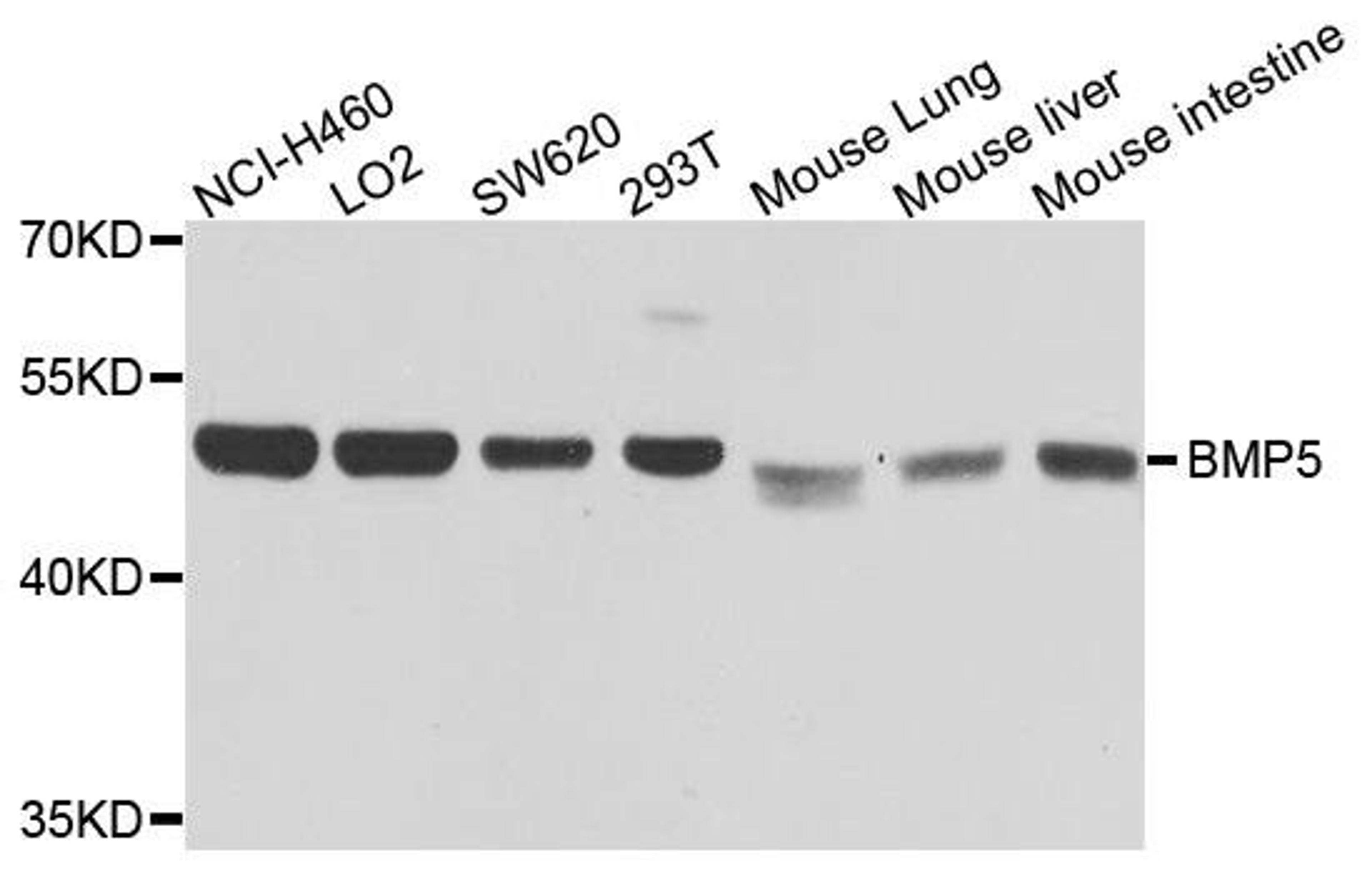 Western blot analysis of extracts of various cells using BMP5 antibody