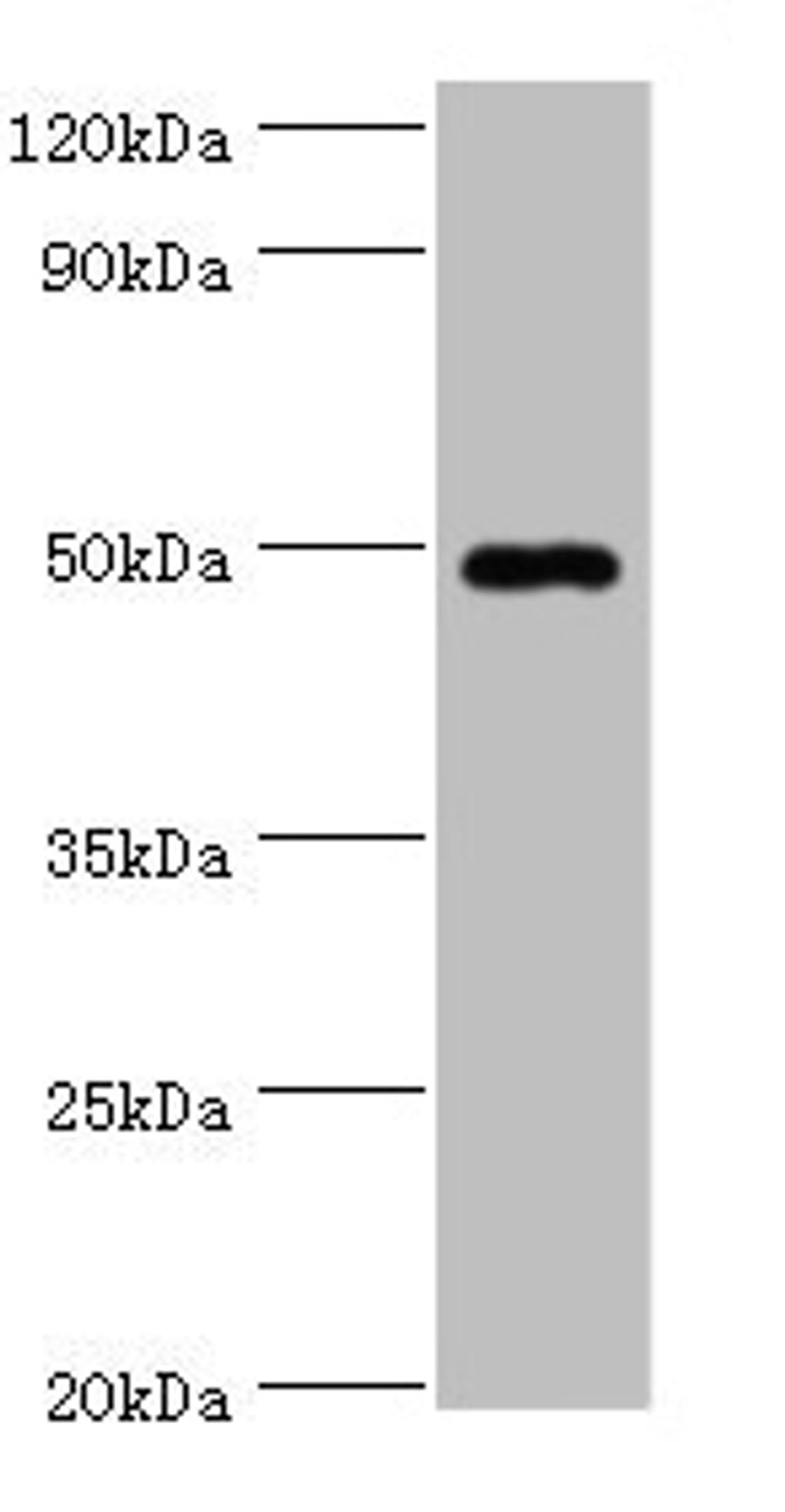 Western blot. All lanes: HYAL1 antibody at 2µg/ml + HepG2 whole cell lysate. Secondary. Goat polyclonal to rabbit IgG at 1/10000 dilution. Predicted band size: 49, 46, 28, 24, 20, 11, 38 kDa. Observed band size: 49 kDa