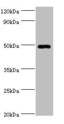 Western blot. All lanes: HYAL1 antibody at 2µg/ml + HepG2 whole cell lysate. Secondary. Goat polyclonal to rabbit IgG at 1/10000 dilution. Predicted band size: 49, 46, 28, 24, 20, 11, 38 kDa. Observed band size: 49 kDa