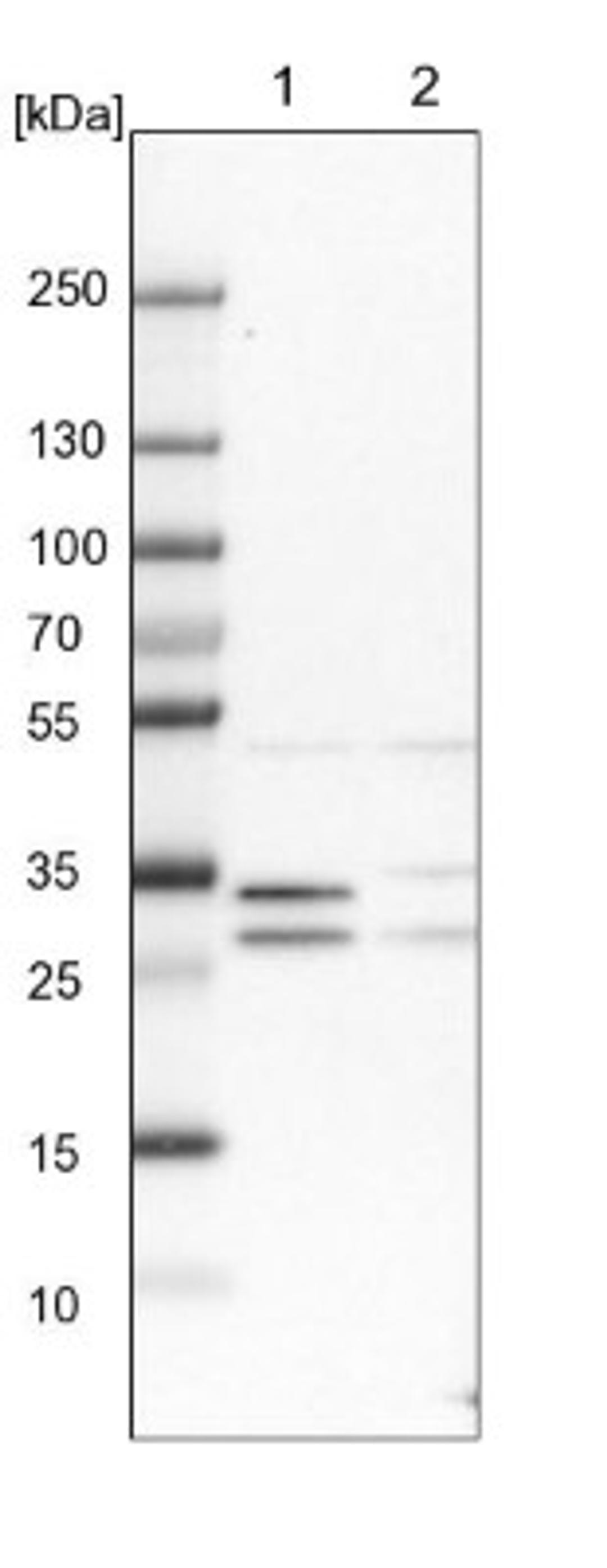 Western Blot: DDAH2 Antibody [NBP1-86092] - Lane 1: NIH-3T3 cell lysate (Mouse embryonic fibroblast cells)<br/>Lane 2: NBT-II cell lysate (Rat Wistar bladder tumour cells)