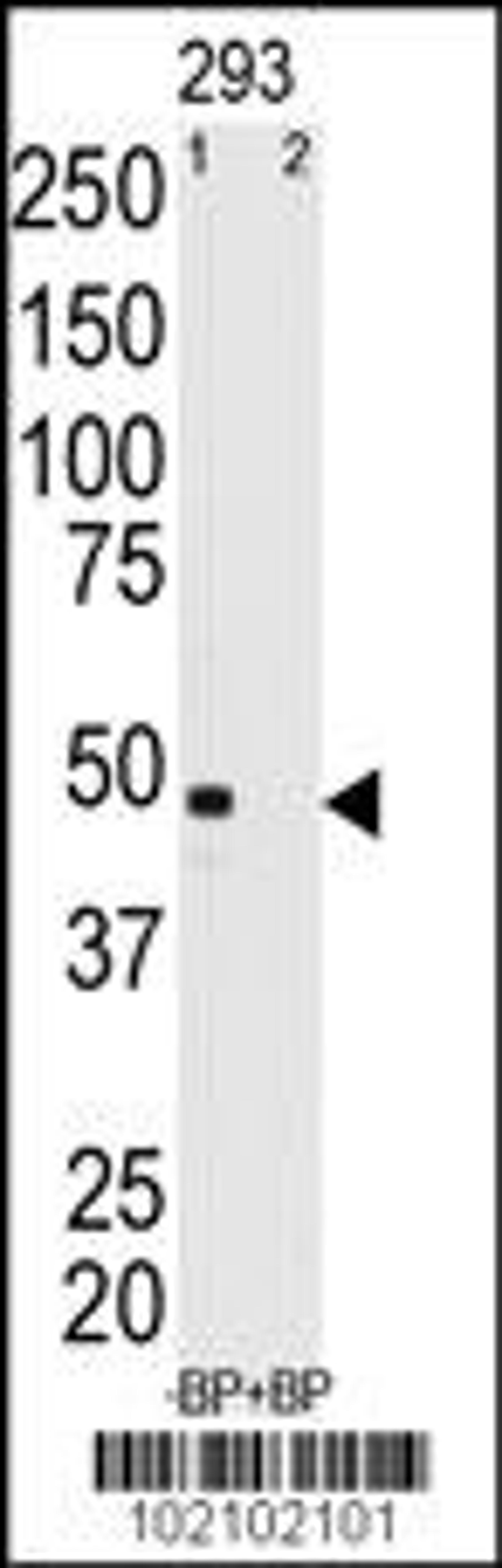 Western blot analysis of anti-MAGEA11 Antibody pre-incubated with and without blocking peptide in 293 cell line lysate.