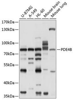 Western blot - PDE4B antibody (A10196)