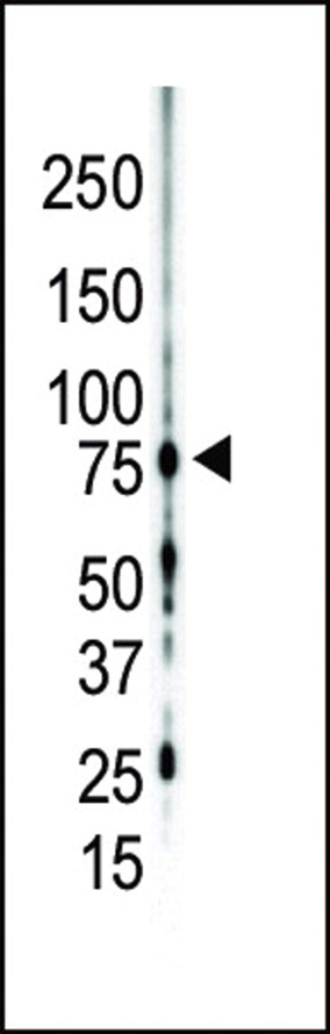 Western blot analysis of anti-PKC gamma C-term Pab in mouse brain lysate. PKC gamma was detected using purified Pab.