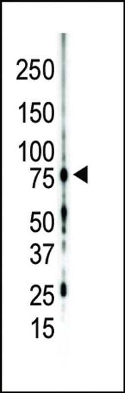 Western blot analysis of anti-PKC gamma C-term Pab in mouse brain lysate. PKC gamma was detected using purified Pab.