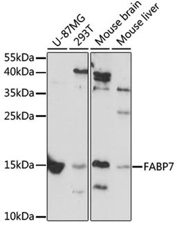 Western blot - FABP7 antibody (A11604)