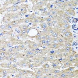 Immunohistochemical staining of human liver tissue using DFNA5 antibody