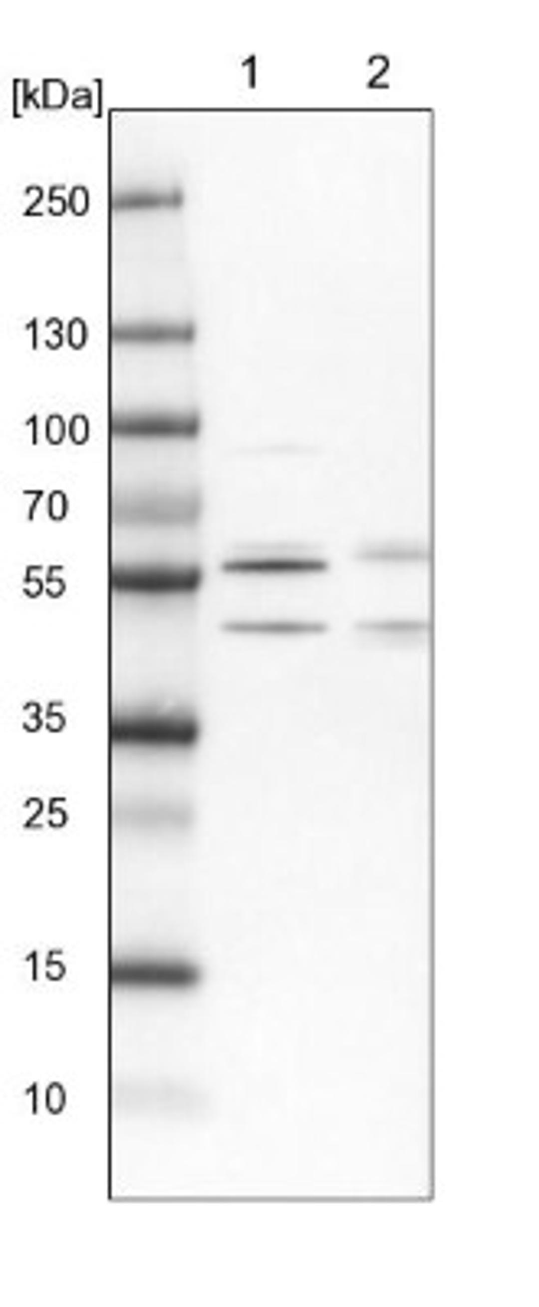 Western Blot: WBP4 Antibody [NBP1-84718] - Lane 1: NIH-3T3 cell lysate (Mouse embryonic fibroblast cells)<br/>Lane 2: NBT-II cell lysate (Rat Wistar bladder tumour cells)