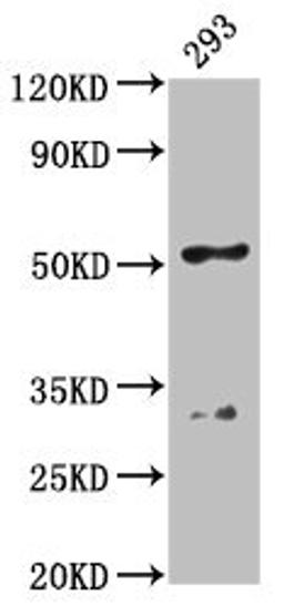 Western Blot. Positive WB detected in: 293 whole cell lysate. All lanes: FIZ1 antibody at 4.5µg/ml. Secondary. Goat polyclonal to rabbit IgG at 1/50000 dilution. Predicted band size: 52 kDa. Observed band size: 52 kDa