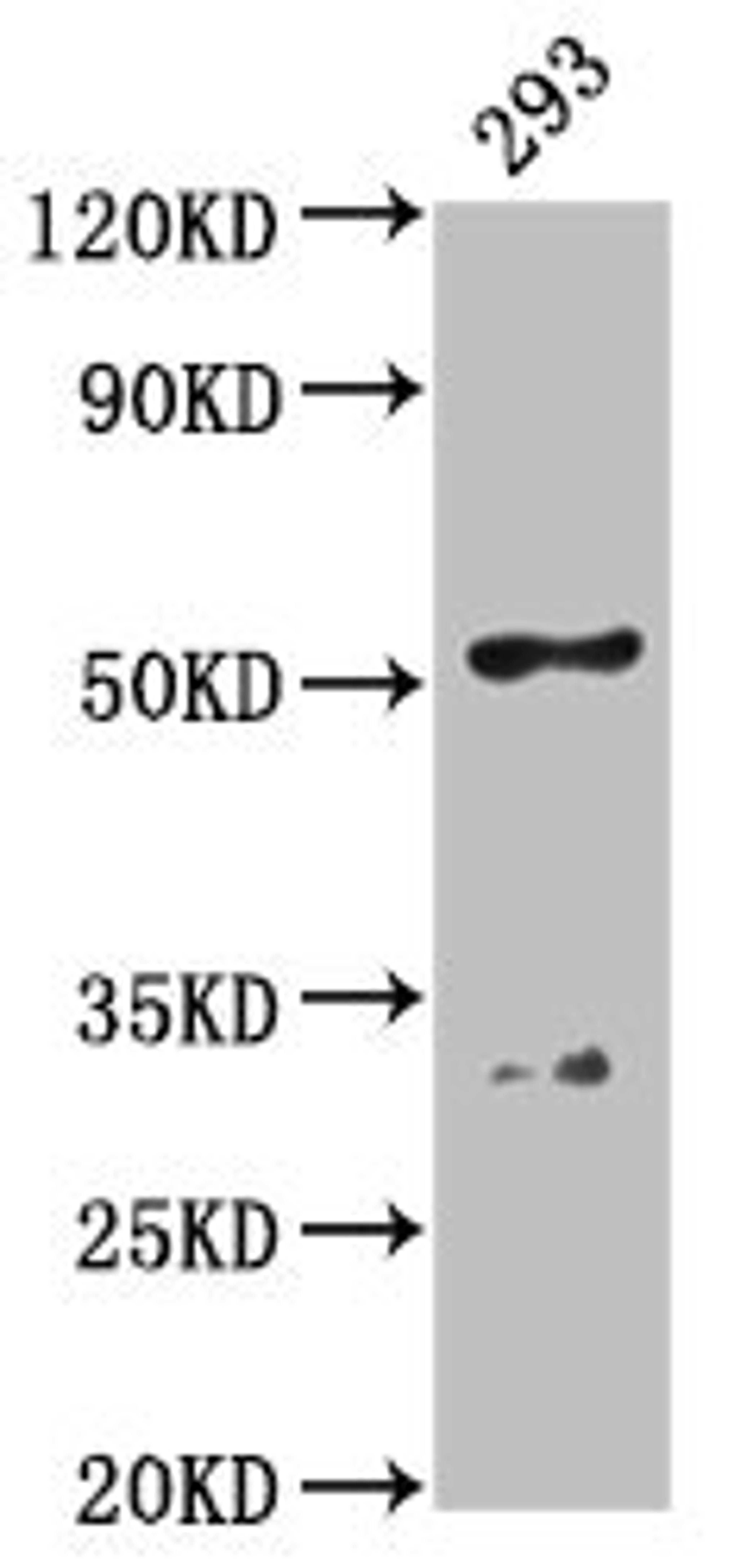 Western Blot. Positive WB detected in: 293 whole cell lysate. All lanes: FIZ1 antibody at 4.5µg/ml. Secondary. Goat polyclonal to rabbit IgG at 1/50000 dilution. Predicted band size: 52 kDa. Observed band size: 52 kDa