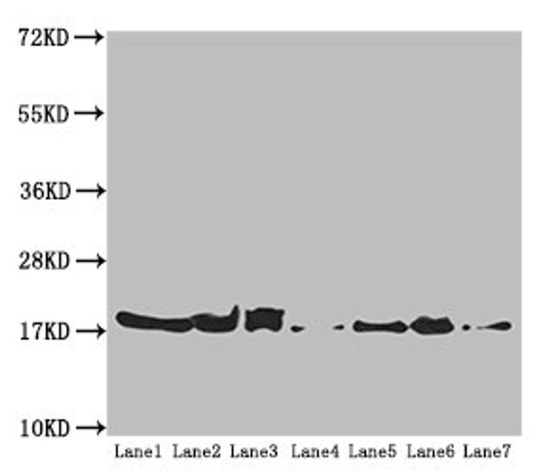 Western blot. All lanes: ATP5H antibody at 5.16 ug/ml. Lane 1: Mouse kidney tissue. Lane 2: Mouse liver tissue. Lane 3: Mouse brain tissue. Lane 4: Hela whole cell lysate. Lane 5: HepG2 whole cell lysate. Lane 6: PC-3 whole cell lysate. Lane 7: U251 whole cell lysate. Secondary. Goat polyclonal to rabbit IgG at 1/10000 dilution. Predicted band size: 19, 16 kDa. Observed band size: 19 kDa. 