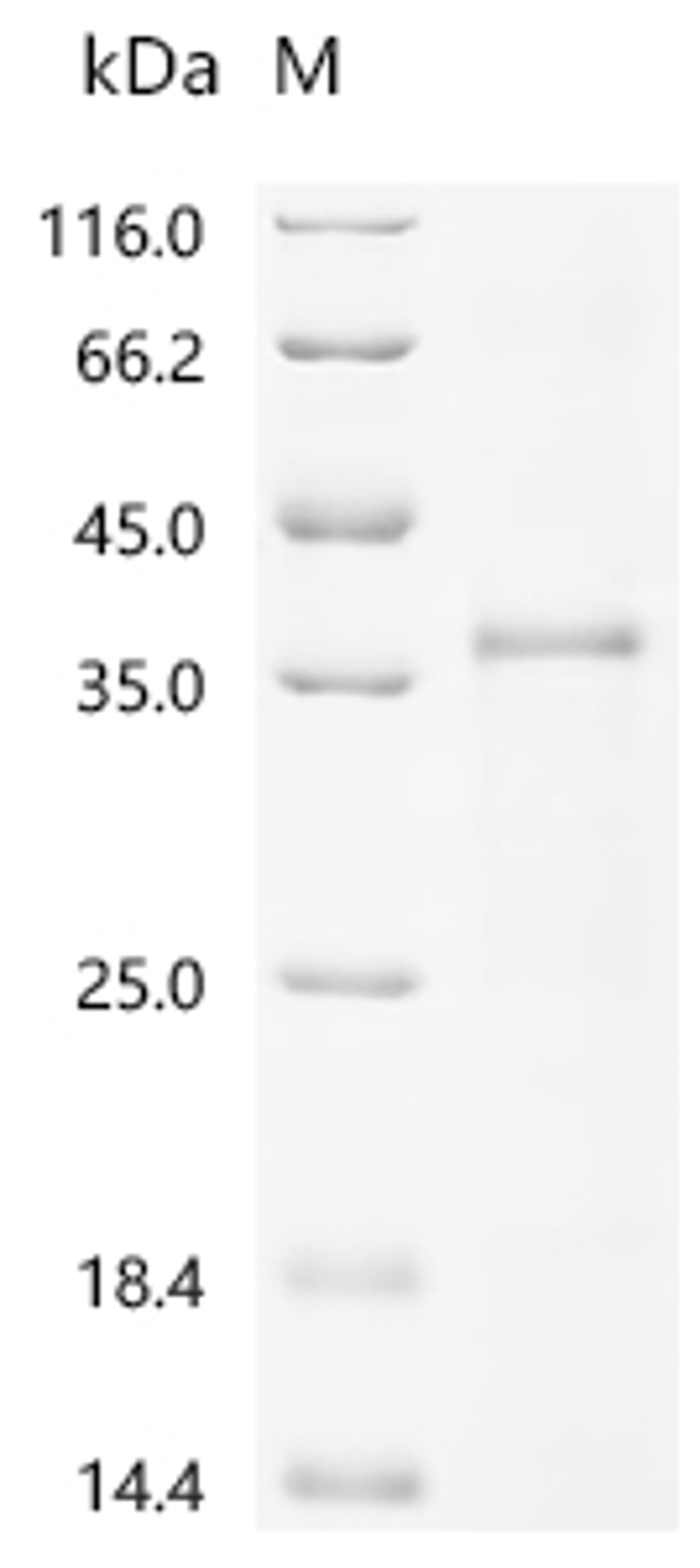 (Tris-Glycine gel) Discontinuous SDS-PAGE (reduced) with 5% enrichment gel and 15% separation gel.