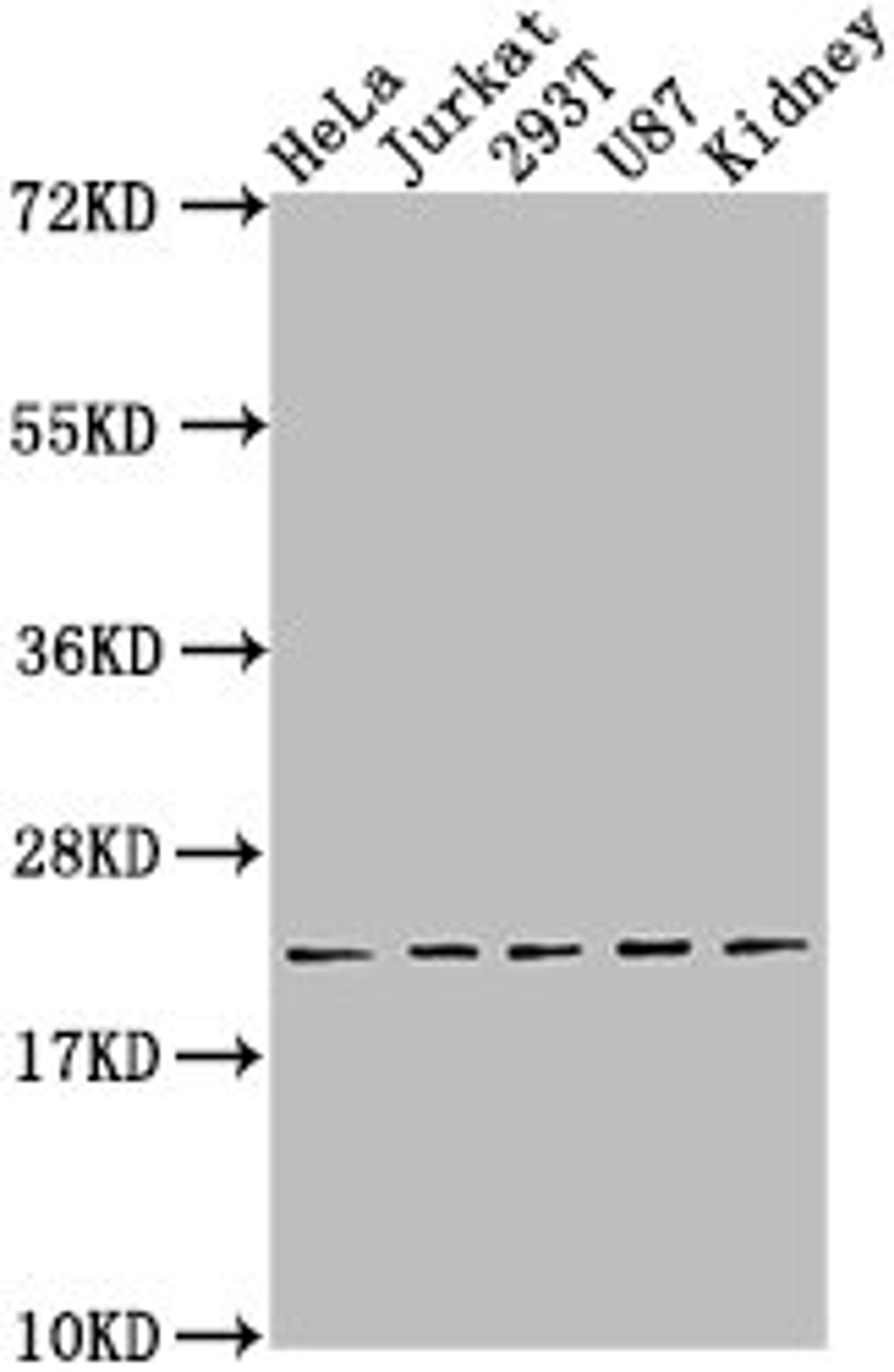 Western Blot. Positive WB detected in: Hela whole cell lysate, Jurkat whole cell lysate, 293T whole cell lysate, U87 whole cell lysate, Rat kidney tissue. All lanes: BBC3 antibody at 1:2000. Secondary. Goat polyclonal to rabbit IgG at 1/50000 dilution. Predicted band size: 21, 15 kDa. Observed band size: 21 kDa