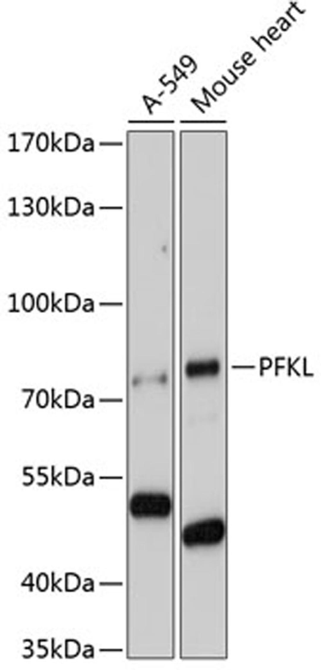 Western blot - PFKL antibody (A7708)