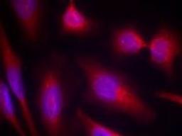 Immunofluorescence staining of methanol-fixed HeLa cells using Tau (Ab-214).