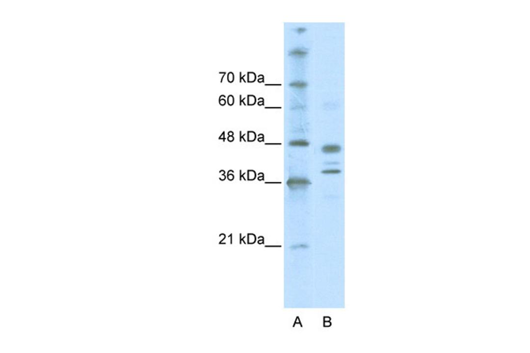 Antibody used in WB on Human Jurkat 0.2-1 ug/ml.