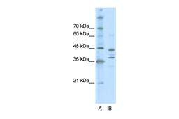 Antibody used in WB on Human Jurkat 0.2-1 ug/ml.