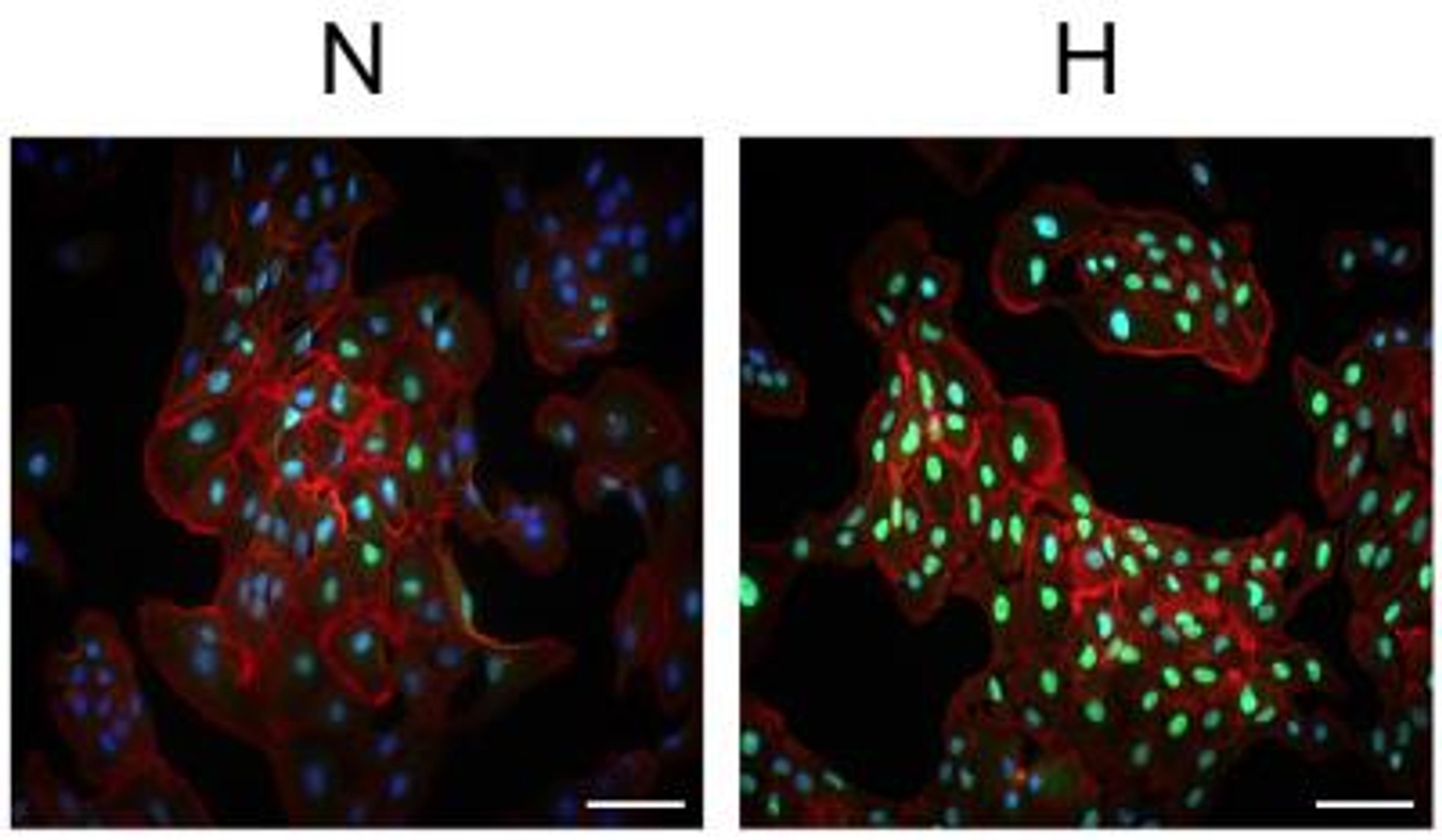 Immunocytochemistry/Immunofluorescence: HIF-1 alpha Antibody [NB100-134] - analysis of HIF-1 alpha in ARPE-19 cells using anti-HIF-1 alpha antibody. Image from verified customer review.