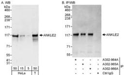 Detection of human ANKLE2 by western blot and immunoprecipitation.