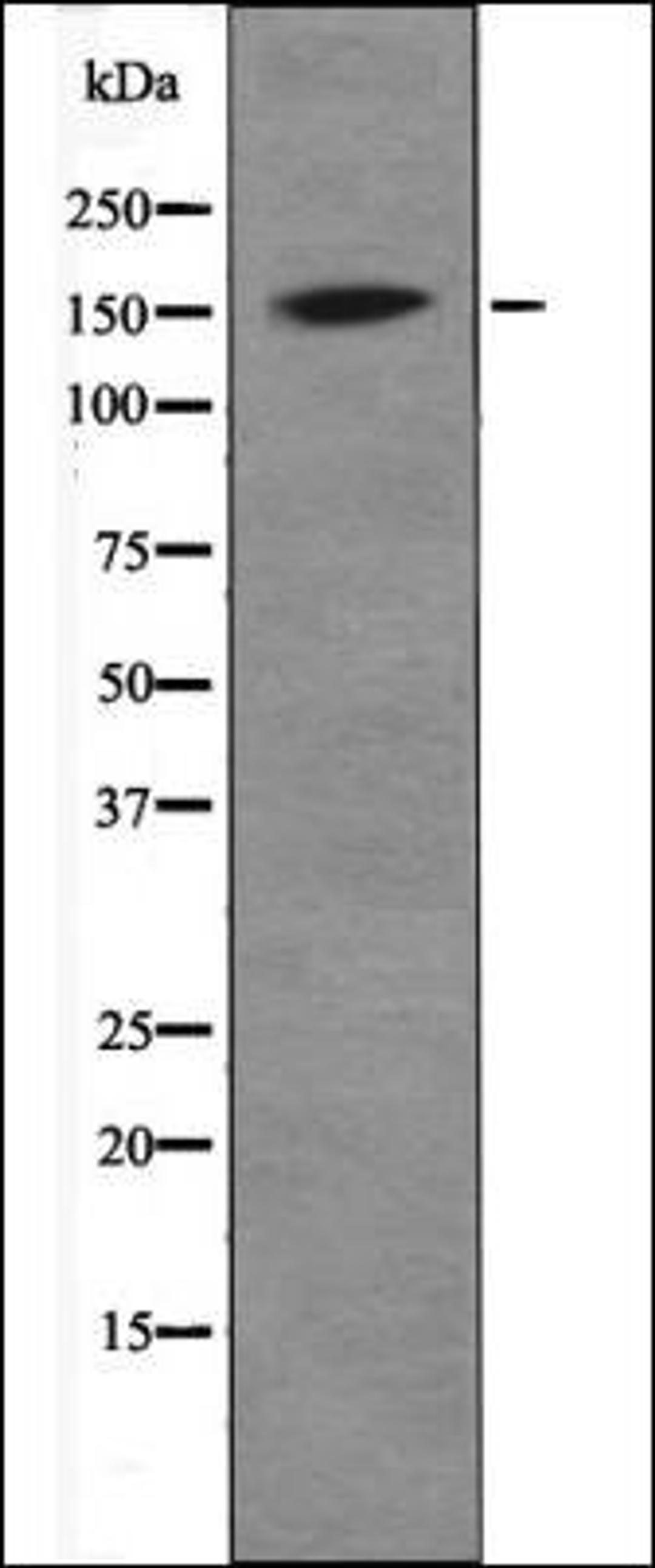 Western blot analysis of EGF treated HepG2 whole cell lysates using DAPK1 -Phospho-Ser308- antibody