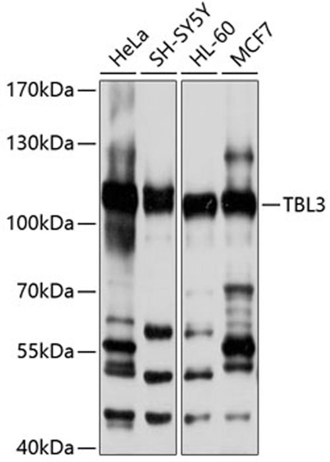 Western blot - TBL3 antibody (A10043)