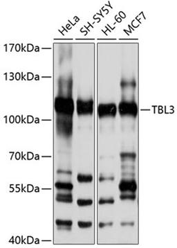 Western blot - TBL3 antibody (A10043)