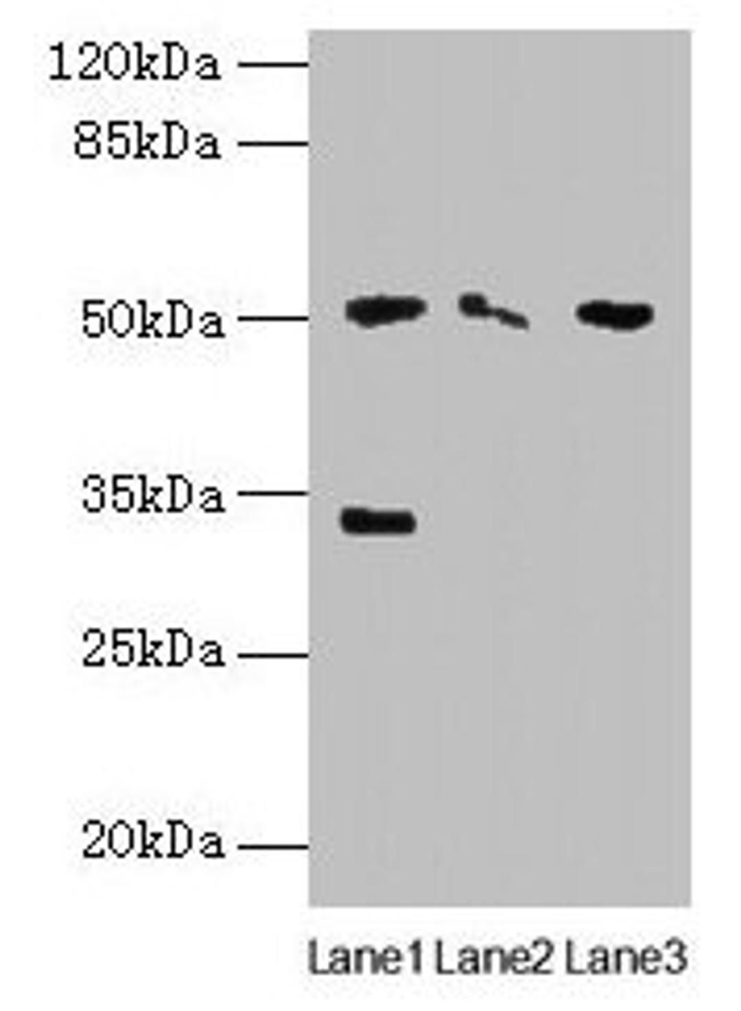 Western blot. All lanes: SLC38A6 antibody at 12µg/ml. Lane 1: Mouse kidney tissue. Lane 2: Mouse thymus tissue. Lane 3: U87 whole cell lysate. Secondary. Goat polyclonal to rabbit IgG at 1/10000 dilution. Predicted band size: 51, 58 kDa. Observed band size: 51, 33 kDa
