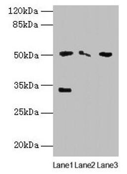 Western blot. All lanes: SLC38A6 antibody at 12µg/ml. Lane 1: Mouse kidney tissue. Lane 2: Mouse thymus tissue. Lane 3: U87 whole cell lysate. Secondary. Goat polyclonal to rabbit IgG at 1/10000 dilution. Predicted band size: 51, 58 kDa. Observed band size: 51, 33 kDa