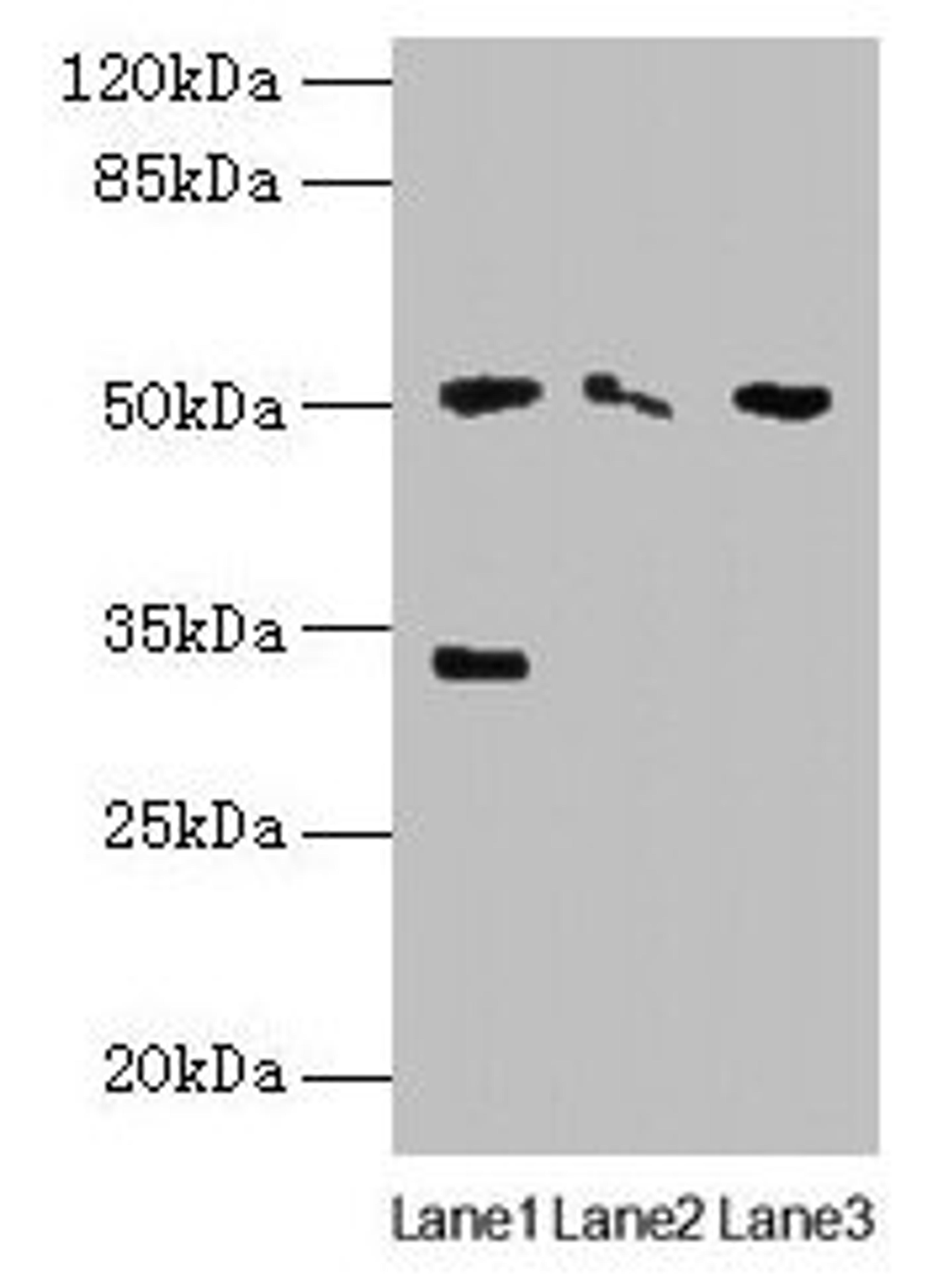 Western blot. All lanes: SLC38A6 antibody at 12µg/ml. Lane 1: Mouse kidney tissue. Lane 2: Mouse thymus tissue. Lane 3: U87 whole cell lysate. Secondary. Goat polyclonal to rabbit IgG at 1/10000 dilution. Predicted band size: 51, 58 kDa. Observed band size: 51, 33 kDa