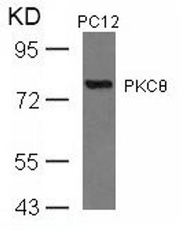 Western blot analysis of lysed extracts from PC12 cells using PKC&#920; (Ab-676).