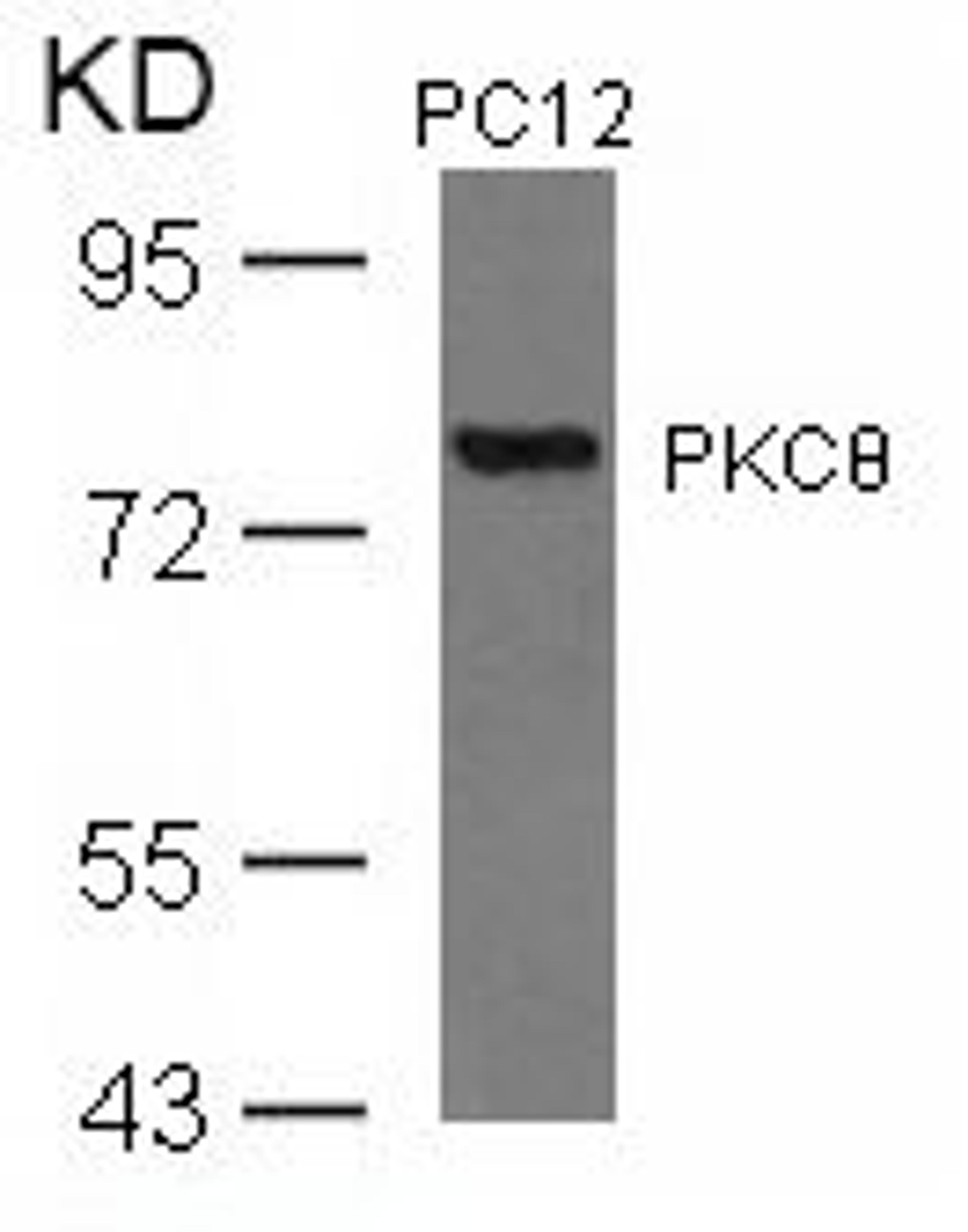 Western blot analysis of lysed extracts from PC12 cells using PKCΘ (Ab-676).