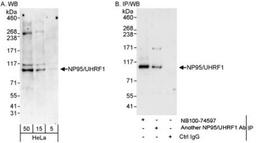 Western Blot: UHRF1 Antibody [NB100-74597] - Whole cell lysate (5, 15 and 50 mcg for WB; 1 mg for IP, 20% of IP loaded) from HeLa cells.  NB100-74597 used for WB at 0.04 mcg/ml (A) and 1 mcg/ml (B) and used for IP at 3 mcg/mg lysate.