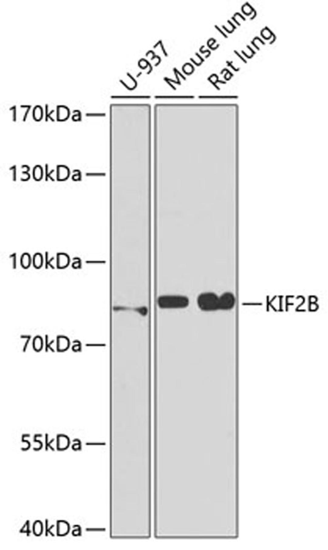 Western blot - KIF2B antibody (A6480)