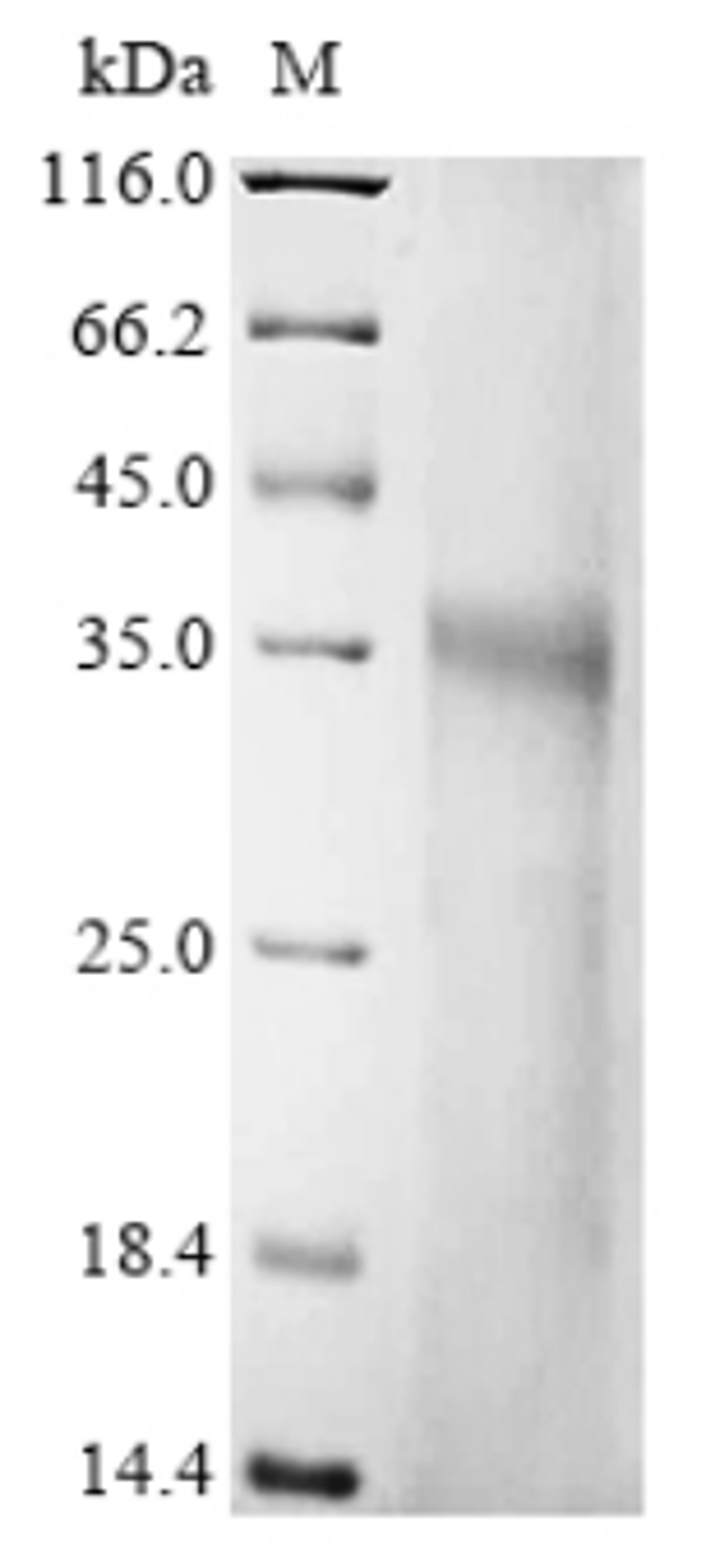(Tris-Glycine gel) Discontinuous SDS-PAGE (reduced) with 5% enrichment gel and 15% separation gel.