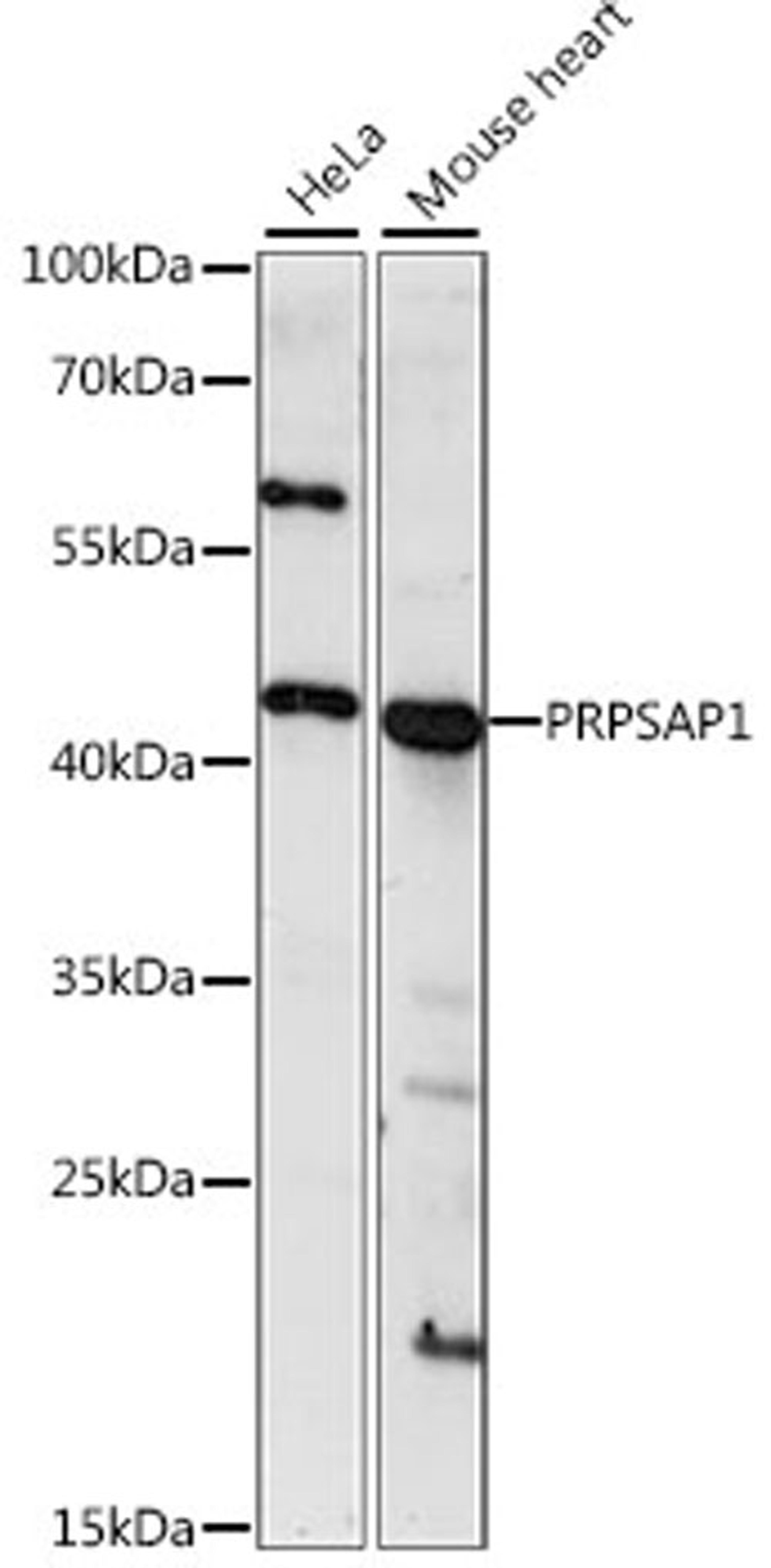 Western blot - PRPSAP1 antibody (A15710)