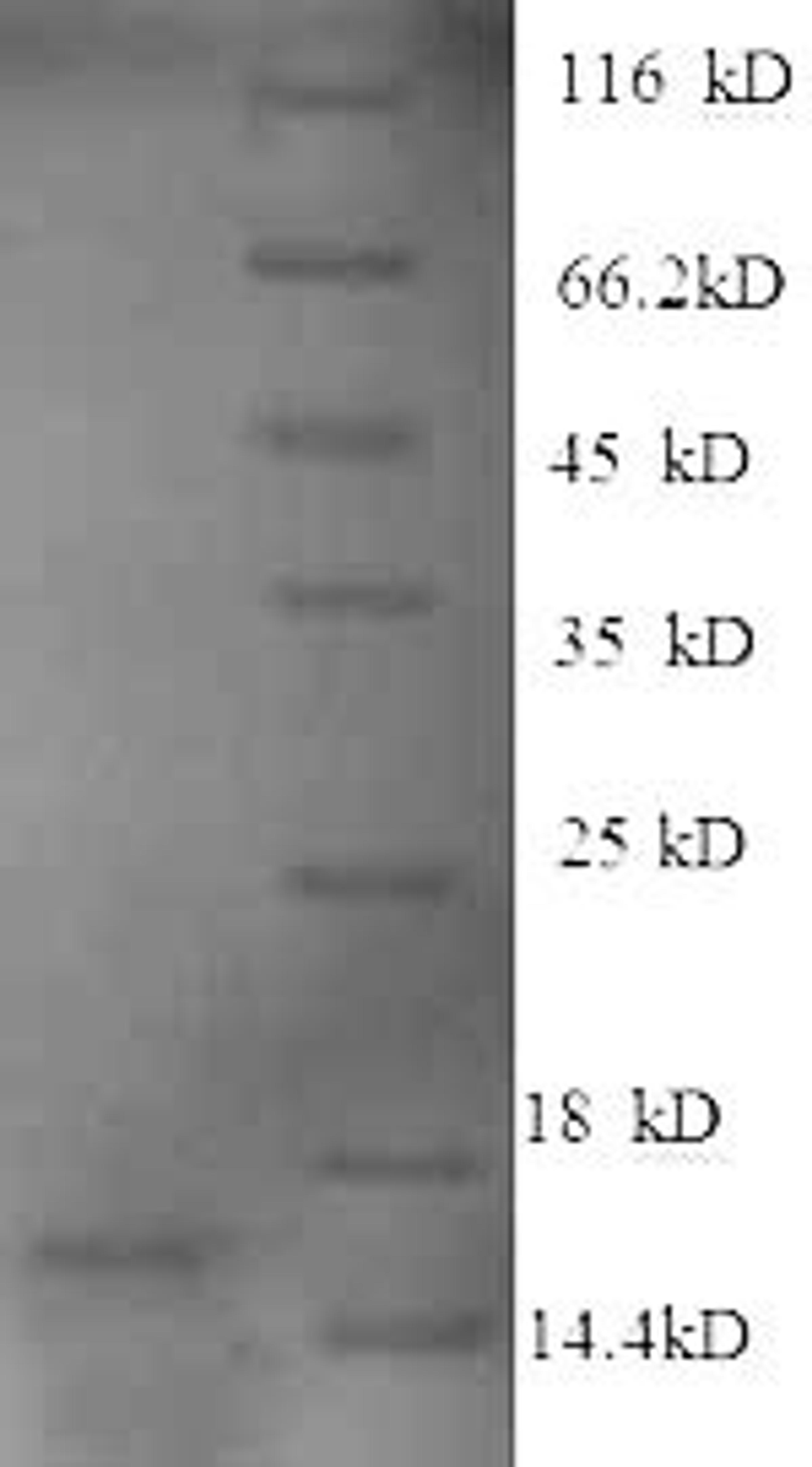 (Tris-Glycine gel) Discontinuous SDS-PAGE (reduced) with 5% enrichment gel and 15% separation gel.