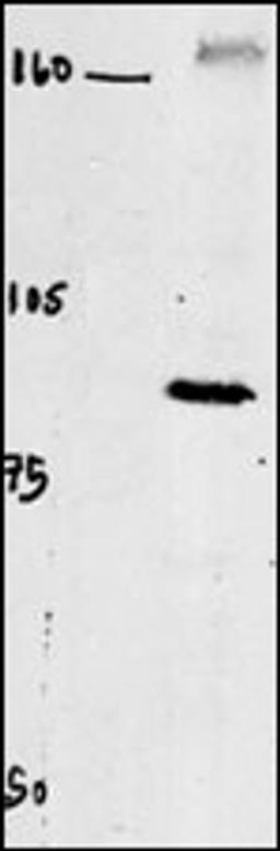 Western blot of chicken brain tissue incubated with CLC4 Antibody . Data courtesy of Emily McMains, Louisiana State University.