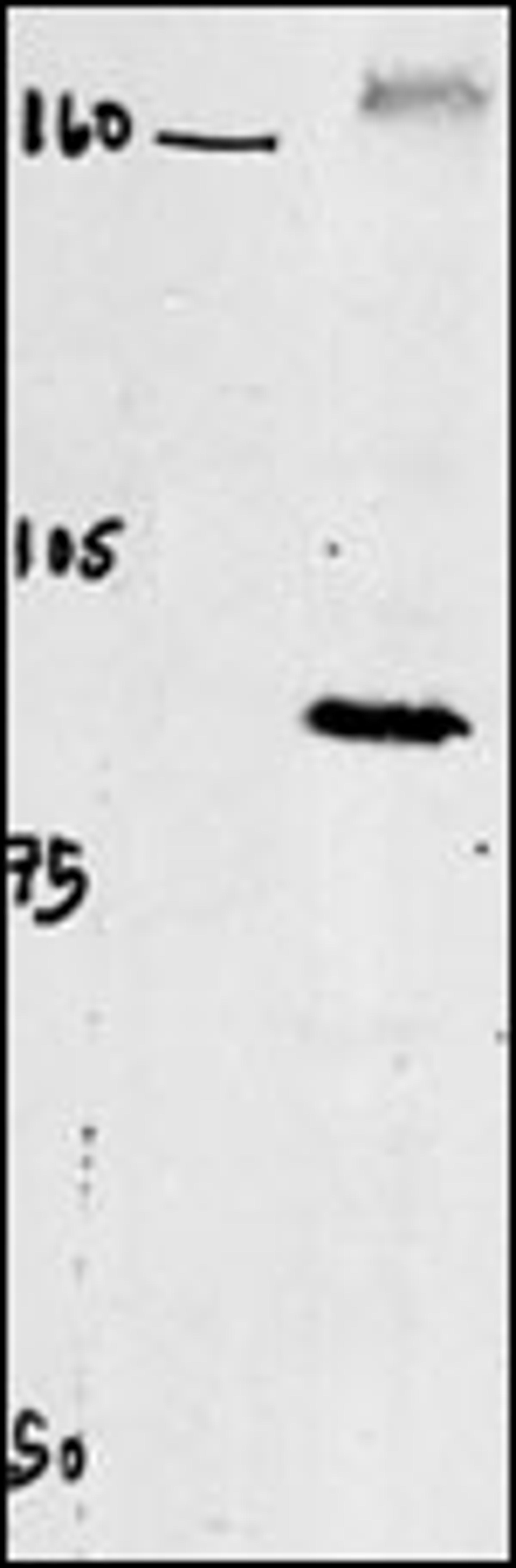 Western blot of chicken brain tissue incubated with CLC4 Antibody . Data courtesy of Emily McMains, Louisiana State University.