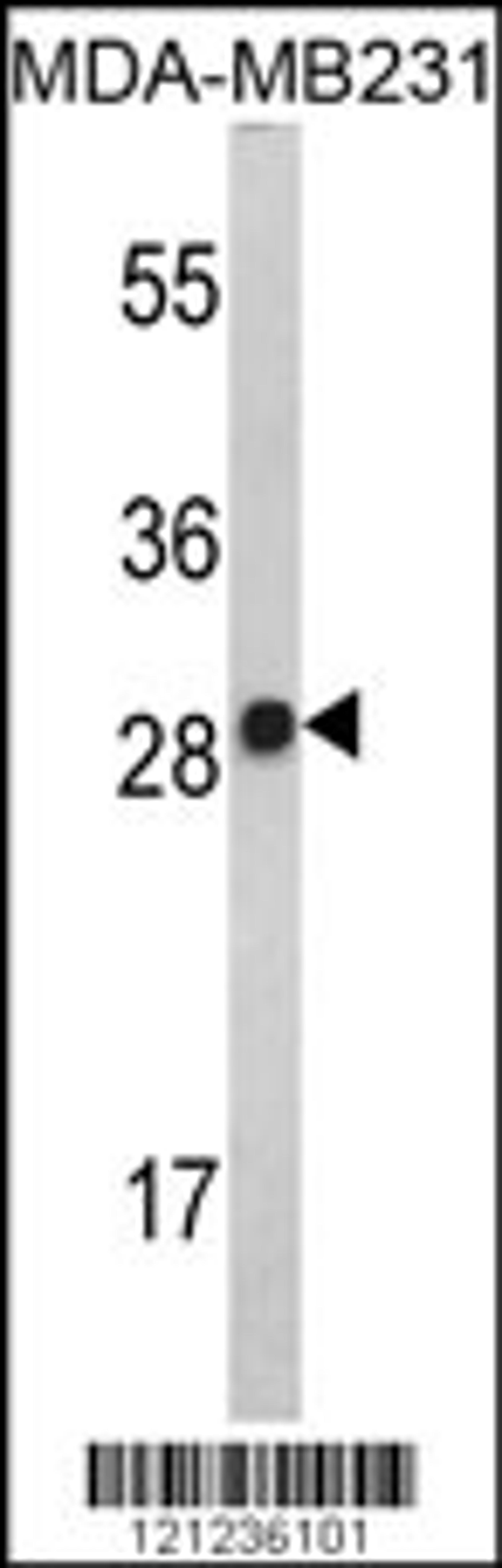 Western blot analysis of IL2 Antibody in MDA-MB231 cell line lysates (35ug/lane)