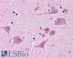 46-464 (5ug/ml) staining of paraffin embedded Human Cortex. Steamed antigen retrieval with citrate buffer pH 6, AP-staining.