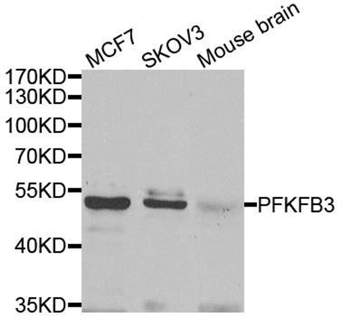 Western blot analysis of extracts of various cell lines using PFKFB3 antibody