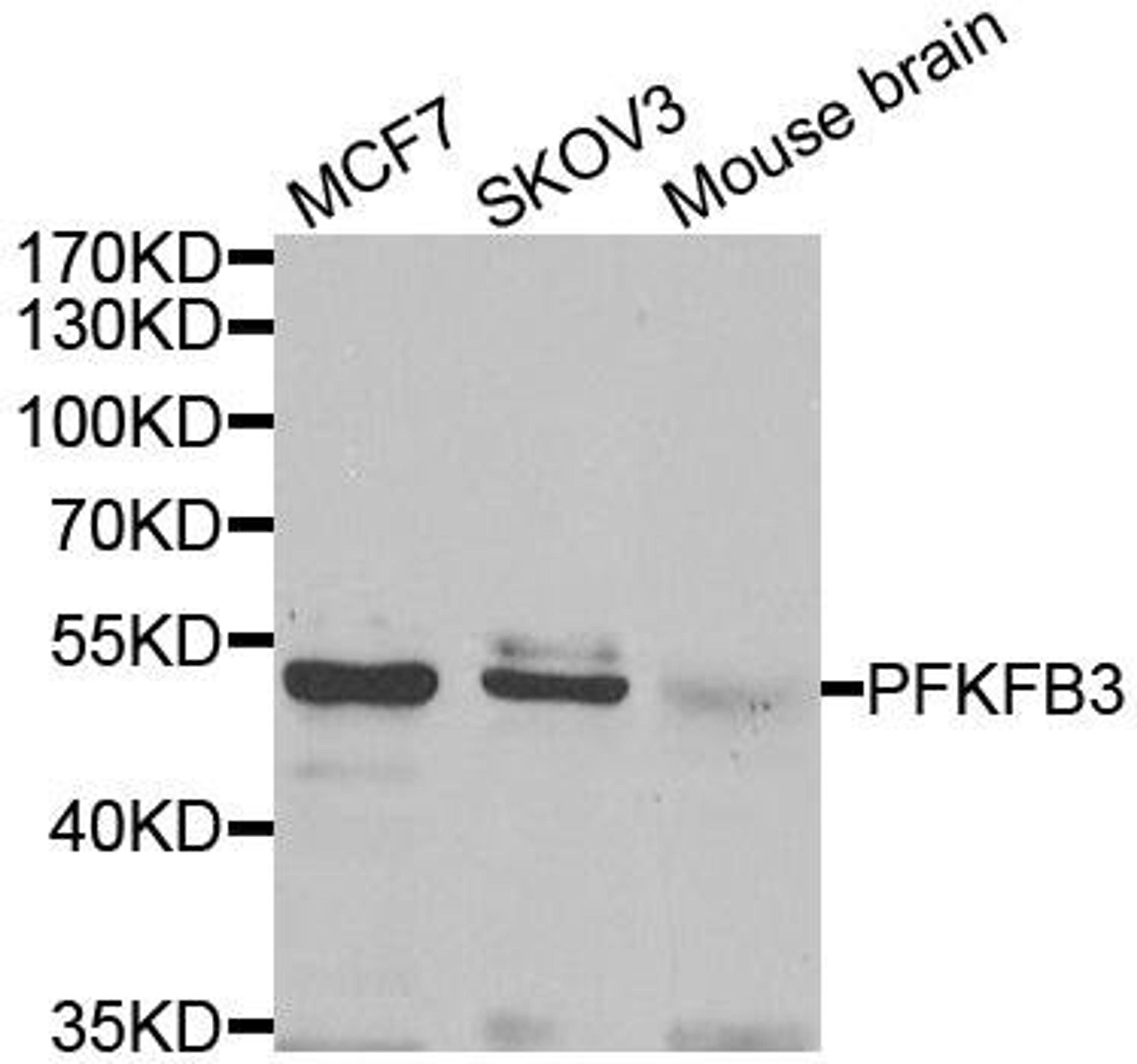 Western blot analysis of extracts of various cell lines using PFKFB3 antibody