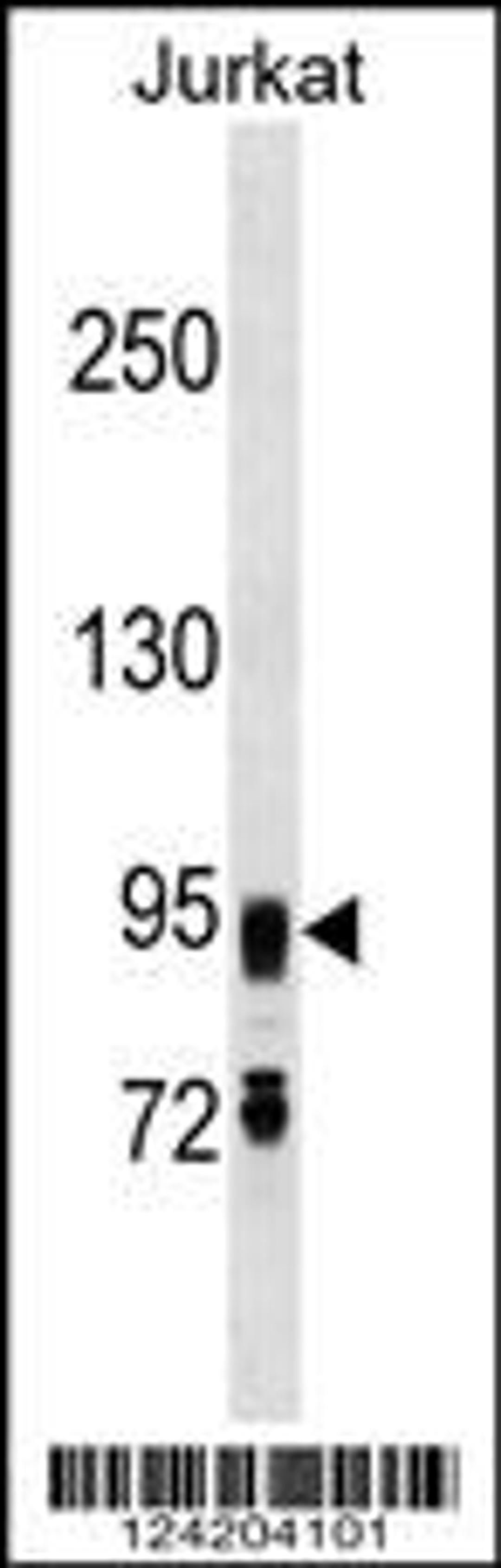 Western blot analysis in Jurkat cell line lysates (35ug/lane).