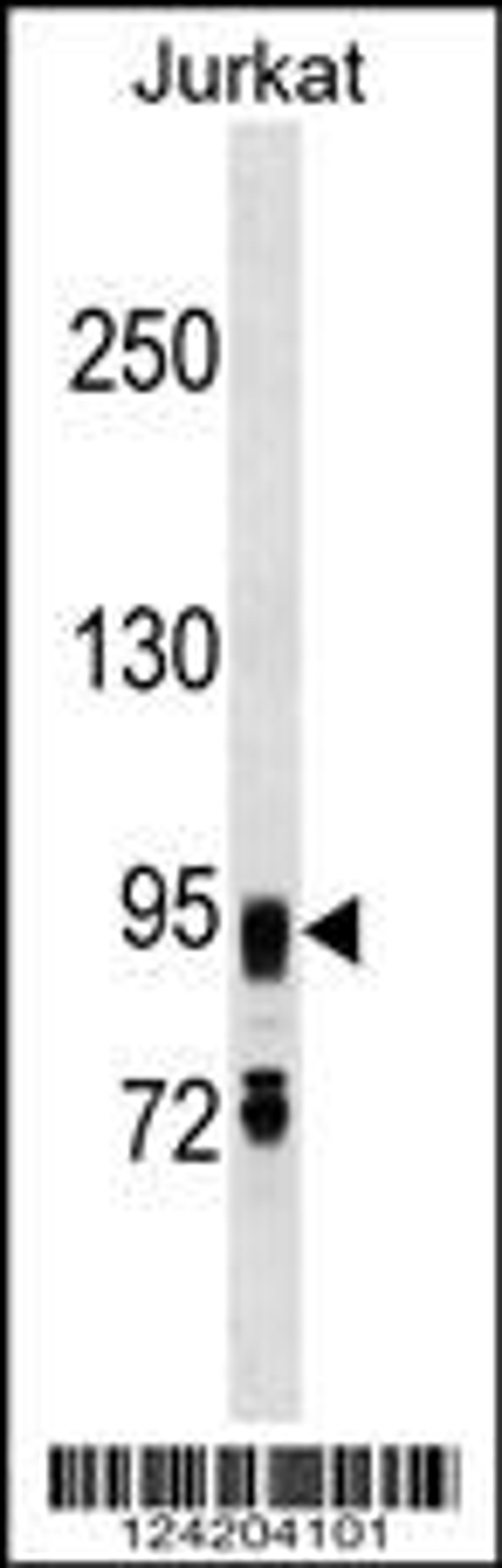 Western blot analysis in Jurkat cell line lysates (35ug/lane).