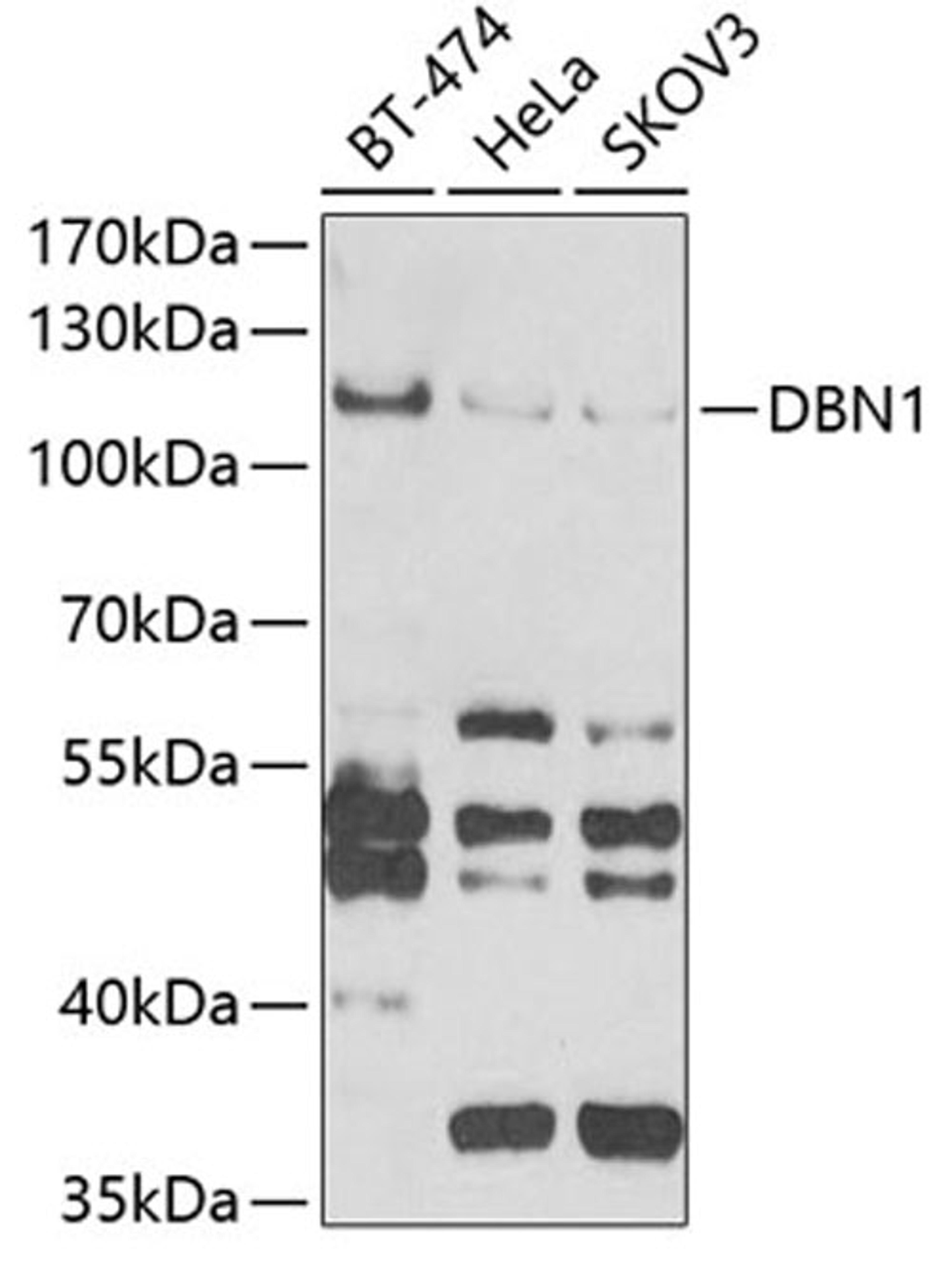 Western blot - DBN1 antibody (A6366)