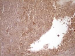 Immunohistochemistry: Protein Z Antibody (4D5) [NBP2-45405] - Analysis of Human tonsil tissue. (Heat-induced epitope retrieval by 1 mM EDTA in 10mM Tris, pH8.5, 120C for 3min)