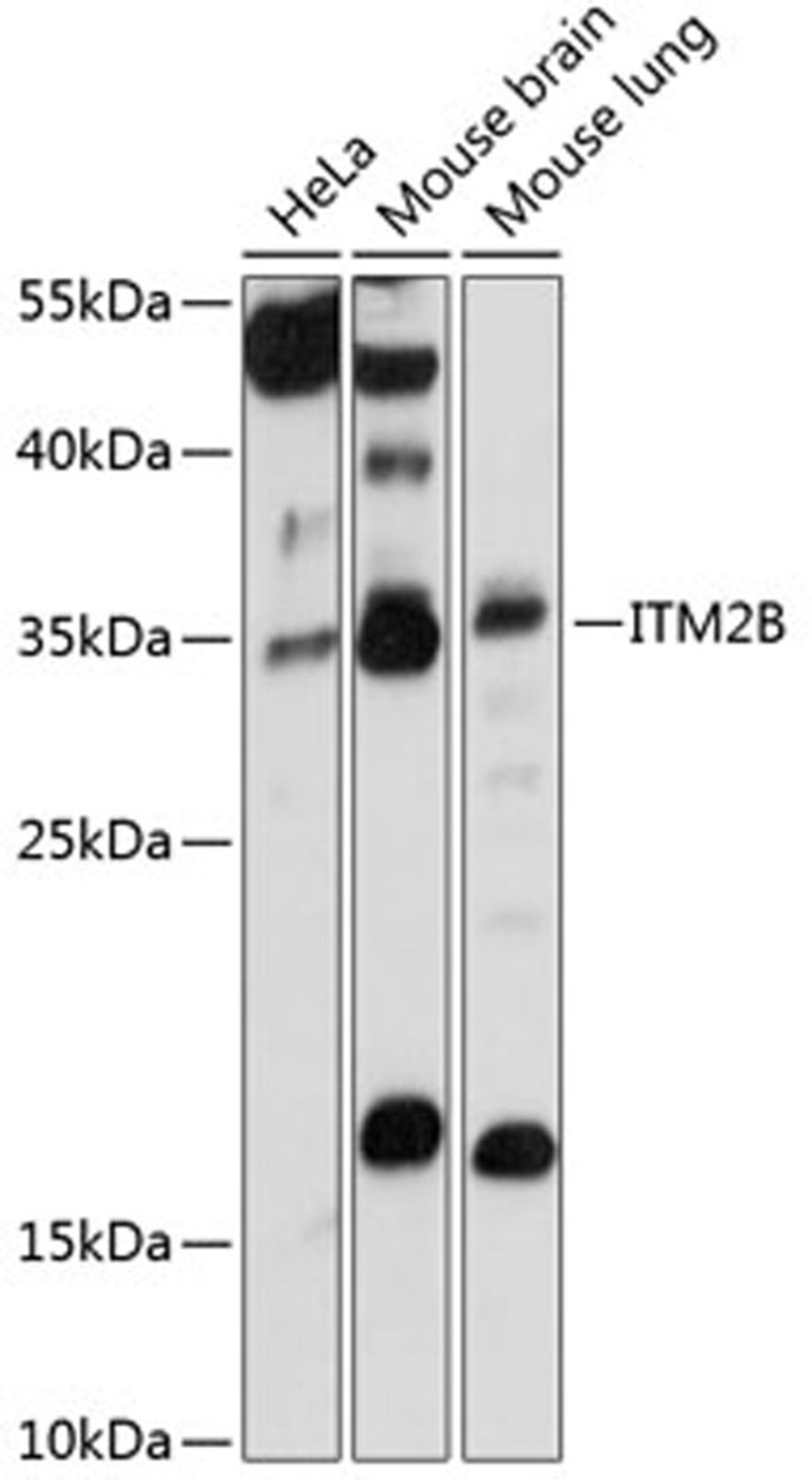 Western blot - ITM2B antibody (A14824)